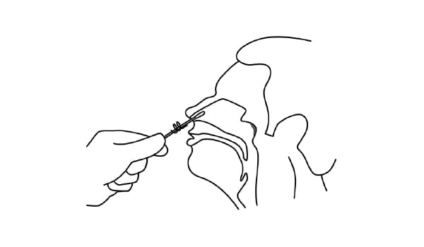 BioTeke®Sterile Disposable Virus Sampling Swab Kit 17 Z